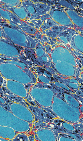 Лыжи в СССР: